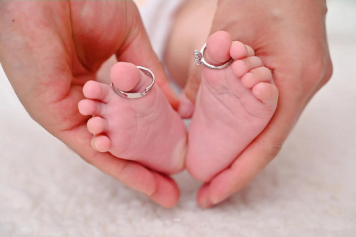 磐石怀孕妊娠线不明显 磐石怀孕妊娠线不明显